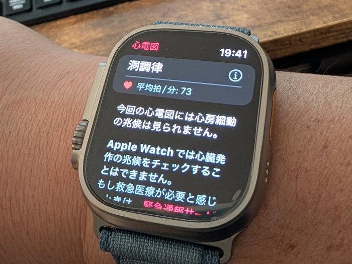 アップルウォッチウルトラ3 心臓の動き